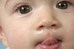 biểu hiện bệnh sổ mũi ở trẻ nhỏ