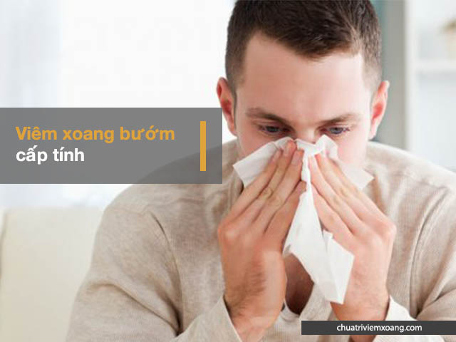 Viêm xoang bướm cấp tính