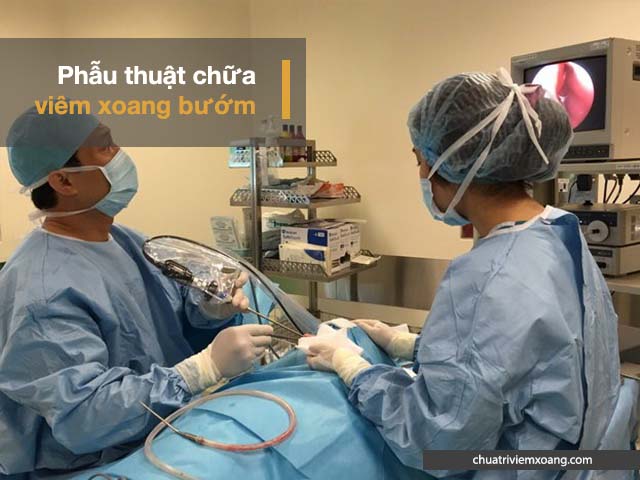 phẫu thuật điều trị viêm xoang bướm