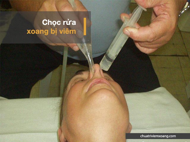 chọc rửa xoang mũi