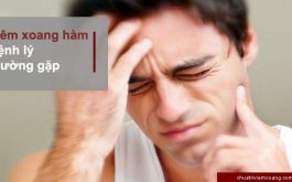 bệnh viêm xoang hàm