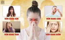 Phân biệt viêm xoang hàm, sàng, trán, bướm và cách điều trị hiệu quả